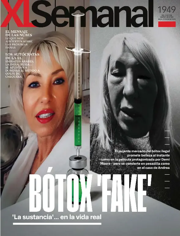 BÓTOX 'FAKE'