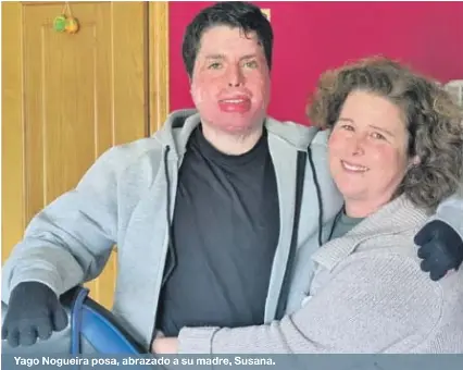 “SE PUIDERA, VOLVERÍA APAGAR OS INCENDIOS”