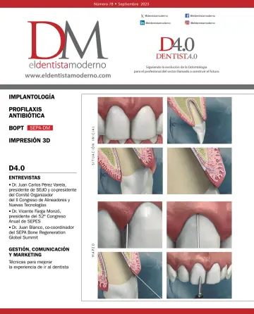 El Dentista Moderno - 01 9月 2023